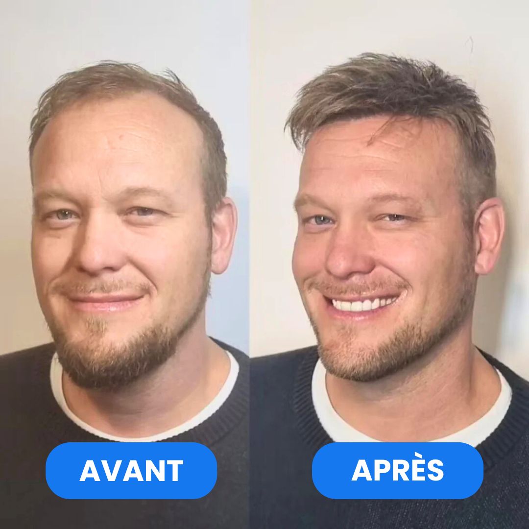 Sérum Roll-On Activateur de Pousse