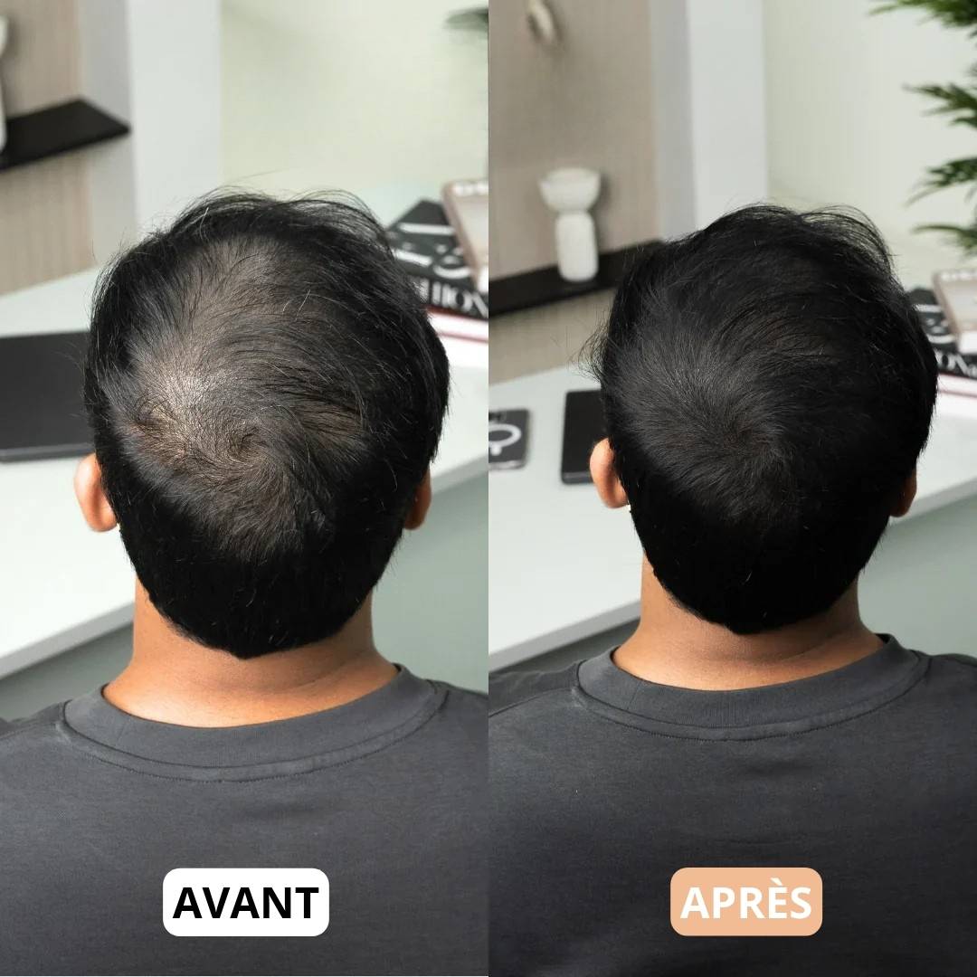 Poudre de Camouflage Capillaire