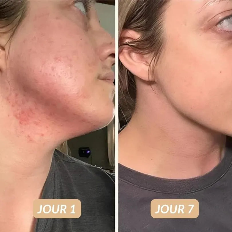 Crème Hydratante Réparatrice K-Beauty