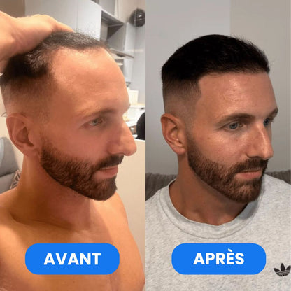 Sérum Roll-On Activateur de Pousse