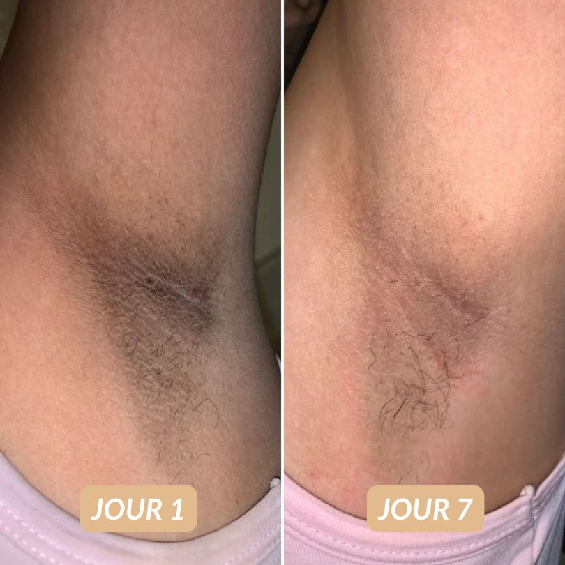 Crème Hydratante Réparatrice K-Beauty