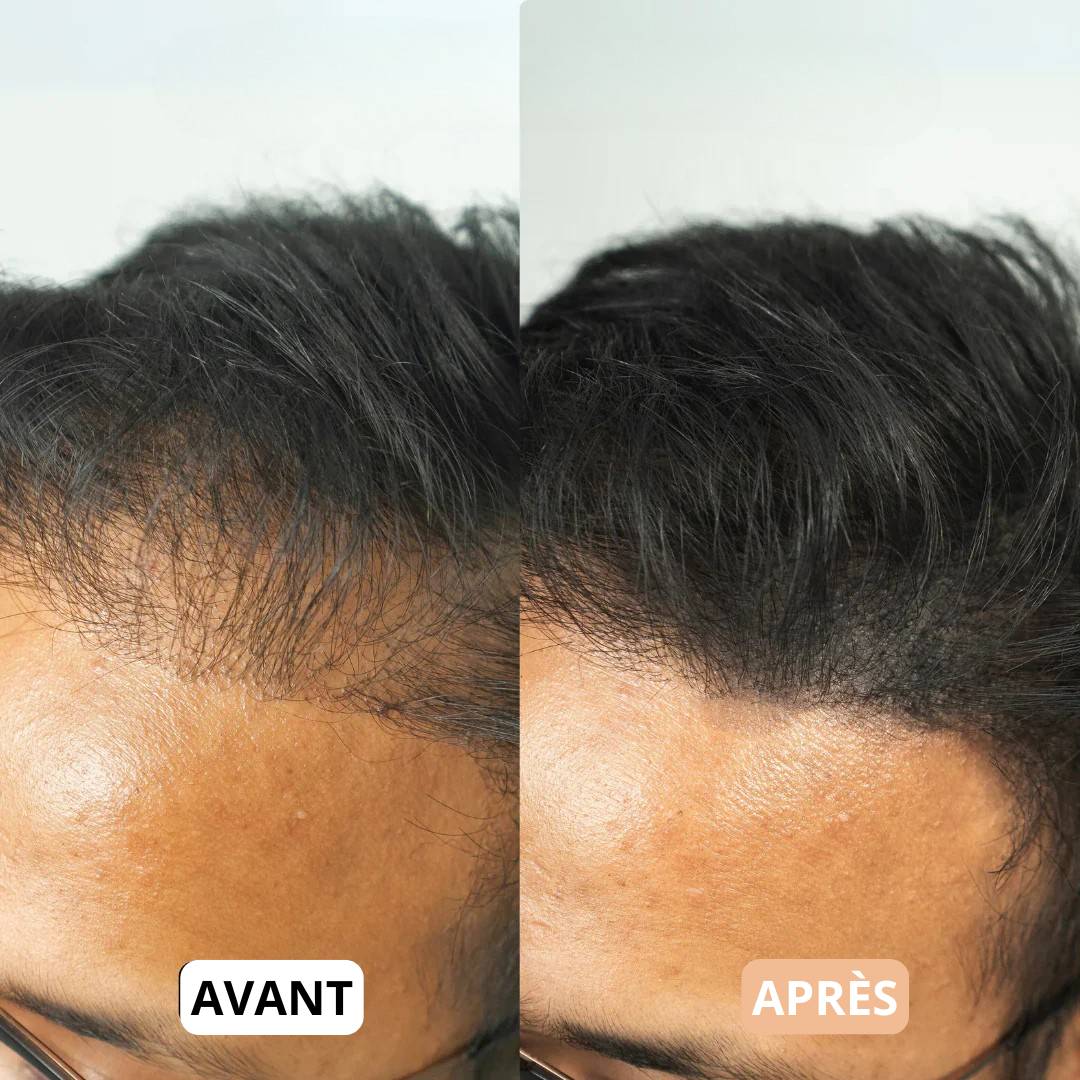 Poudre de Camouflage Capillaire