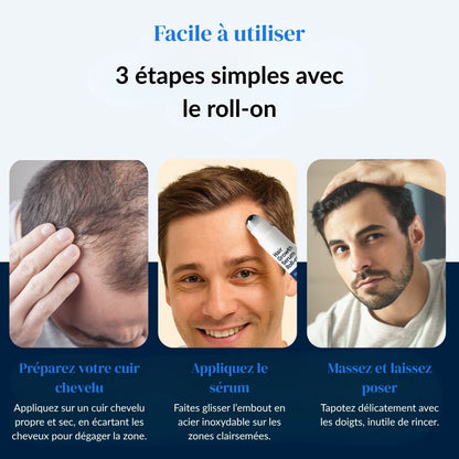 Sérum Roll-On Activateur de Pousse