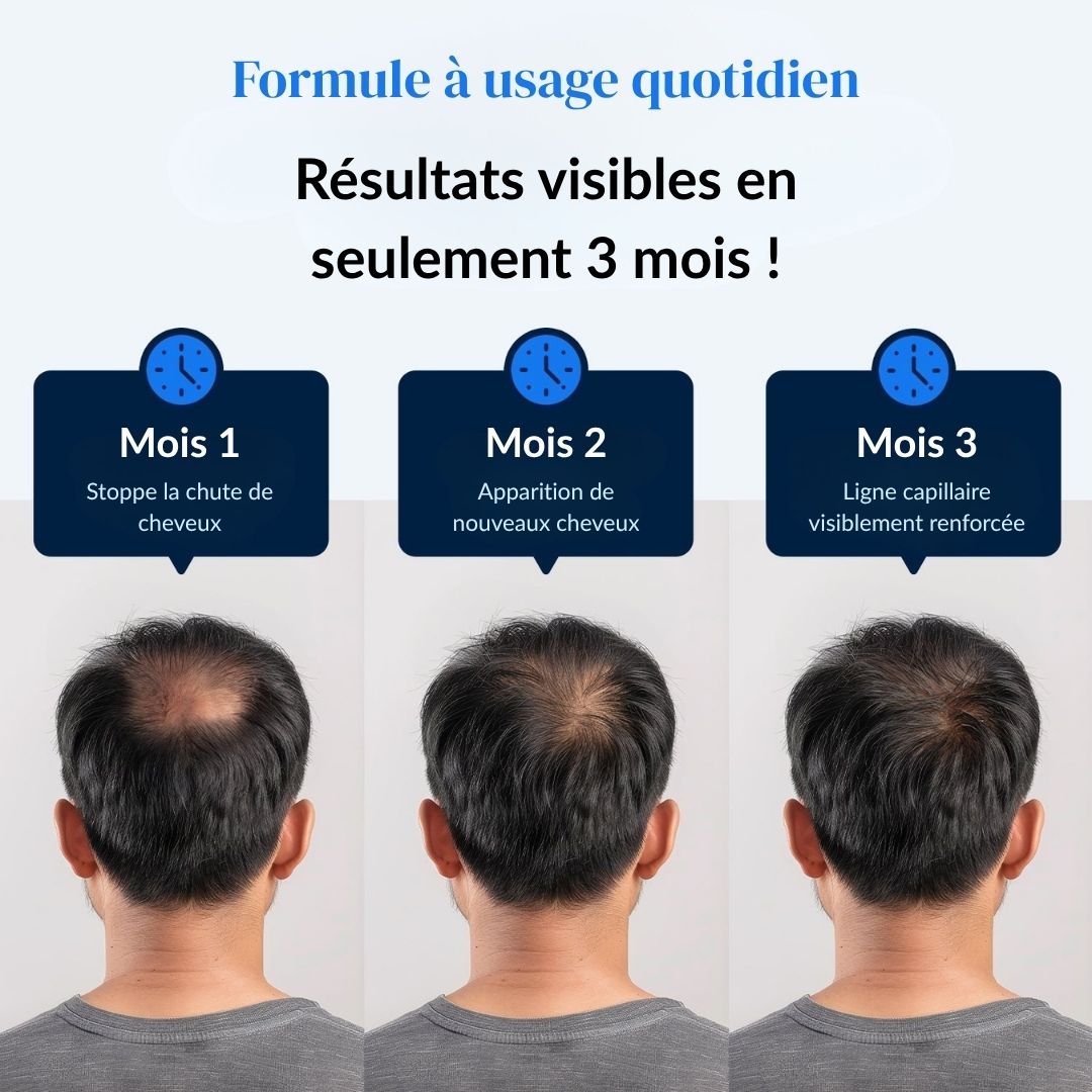 Sérum Roll-On Activateur de Pousse