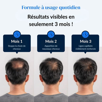 Sérum Roll-On Activateur de Pousse